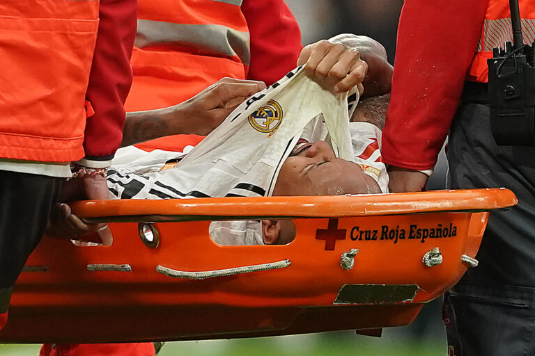 Real Madrid&#039;s Eder Militao injiured during La Liga match. November 9, 2024. (Photo by Acero/Alter Photos/Sipa USA)
2024.11.09 Madryt
pilka nozna liga hiszpanska
Real Madryt - Osasuna Pampeluna
Foto Acero/Alter Photos/SIPA USA/PressFocus

!!! POLAND ONLY !!!