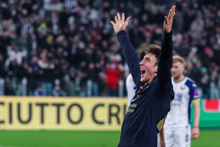 Juventus FC vs Hellas Verona FC - Serie A 2024/25 - 03/03/2025 Andrea Cambiaso of Juventus FC celebrates during Serie A 2024/25 football match between Juventus FC and Hellas Verona FC at Allianz Stadium *** Juventus FC vs Hellas Verona FC Serie A 2024 25 03 03 2025 Andrea Cambiaso of Juventus FC celebrates during Serie A 2024 25 football match between Juventus FC and Hellas Verona FC at Allianz Stadium Copyright: xBEAUTIFULxSPORTS/Carabellix
2025.03.03 Turyn
pilka nozna , liga wloska
Juventus Turyn - Hellas Werona
Foto IMAGO/PressFocus

!!! POLAND ONLY !!!
